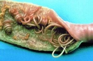 Кръгли червеи