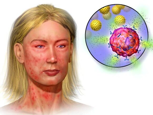 ехинококи и симптоми на тяхното присъствие в тялото